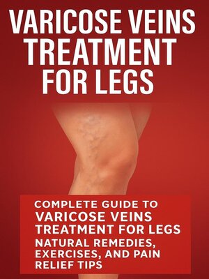 cover image of Varicose Veins Treatment for Legs